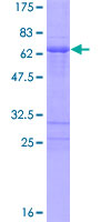 PHOX2A Protein - 12.5% SDS-PAGE of human PHOX2A stained with Coomassie Blue