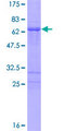 PHOX2A Protein - 12.5% SDS-PAGE of human PHOX2A stained with Coomassie Blue