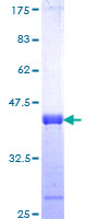 PHRF1 Protein - 12.5% SDS-PAGE Stained with Coomassie Blue.