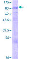 PHTF1 Protein - 12.5% SDS-PAGE of human PHTF1 stained with Coomassie Blue
