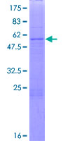 PHYHD1 Protein - 12.5% SDS-PAGE of human PHYHD1 stained with Coomassie Blue