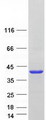 PHYHIP Protein - Purified recombinant protein PHYHIP was analyzed by SDS-PAGE gel and Coomassie Blue Staining