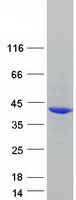PHYHIP Protein - Purified recombinant protein PHYHIP was analyzed by SDS-PAGE gel and Coomassie Blue Staining