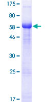 PHYHIPL Protein - 12.5% SDS-PAGE of human PHYHIPL stained with Coomassie Blue