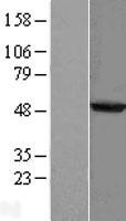 PHYKPL / AGXT2L2 Protein - Western validation with an anti-DDK antibody * L: Control HEK293 lysate R: Over-expression lysate