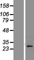 PI15 Protein - Western validation with an anti-DDK antibody * L: Control HEK293 lysate R: Over-expression lysate