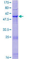 PI15 Protein - 12.5% SDS-PAGE of human PI15 stained with Coomassie Blue