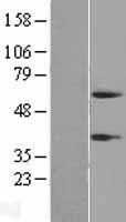 PI16 Protein - Western validation with an anti-DDK antibody * L: Control HEK293 lysate R: Over-expression lysate