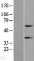 PI16 Protein - Western validation with an anti-DDK antibody * L: Control HEK293 lysate R: Over-expression lysate