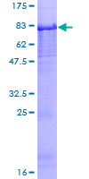 PI16 Protein - 12.5% SDS-PAGE of human PI16 stained with Coomassie Blue