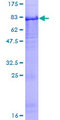 PI16 Protein - 12.5% SDS-PAGE of human PI16 stained with Coomassie Blue