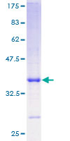 PI3 / Elafin Protein - 12.5% SDS-PAGE of human PI3 stained with Coomassie Blue
