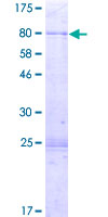 PI4K2A / PI4KII Protein - 12.5% SDS-PAGE of human PI4K2A stained with Coomassie Blue
