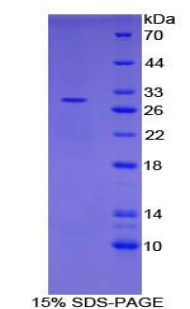 PIAS1 Protein - Recombinant Protein Inhibitor Of Activated STAT 1 By SDS-PAGE