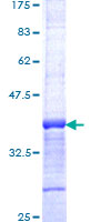 PIAS2 / PIASX Protein - 12.5% SDS-PAGE Stained with Coomassie Blue.