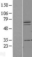 PIAS3 Protein - Western validation with an anti-DDK antibody * L: Control HEK293 lysate R: Over-expression lysate