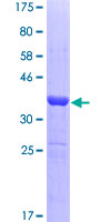 PIAS3 Protein - 12.5% SDS-PAGE Stained with Coomassie Blue.