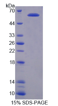 PIAS3 Protein - Recombinant Protein Inhibitor Of Activated STAT 3 By SDS-PAGE