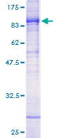 PIAS4 / PIASY Protein - 12.5% SDS-PAGE of human PIAS4 stained with Coomassie Blue