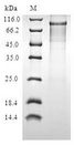 PIBF1 / PIBF Protein - (Tris-Glycine gel) Discontinuous SDS-PAGE (reduced) with 5% enrichment gel and 15% separation gel.