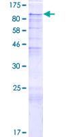 PIBF1 / PIBF Protein - 12.5% SDS-PAGE of human PIBF1 stained with Coomassie Blue