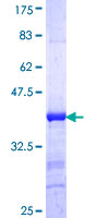 PIBF1 / PIBF Protein - 12.5% SDS-PAGE Stained with Coomassie Blue.