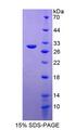 PIBF1 / PIBF Protein - Recombinant Progesterone Immunomodulatory Binding Factor 1 By SDS-PAGE