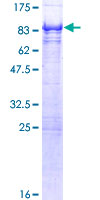 PICALM / CALM Protein - 12.5% SDS-PAGE of human PICALM stained with Coomassie Blue