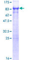 PICALM / CALM Protein - 12.5% SDS-PAGE of human PICALM stained with Coomassie Blue