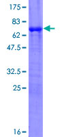 Piccolo Protein - 12.5% SDS-PAGE of human PCLO stained with Coomassie Blue