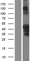 PICK1 Protein - Western validation with an anti-DDK antibody * L: Control HEK293 lysate R: Over-expression lysate