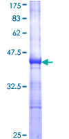 PICK1 Protein - 12.5% SDS-PAGE Stained with Coomassie Blue.