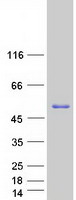 PICK1 Protein - Purified recombinant protein PICK1 was analyzed by SDS-PAGE gel and Coomassie Blue Staining