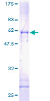 PIG8 / EI24 Protein - 12.5% SDS-PAGE of human EI24 stained with Coomassie Blue