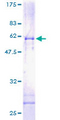 PIG8 / EI24 Protein - 12.5% SDS-PAGE of human EI24 stained with Coomassie Blue