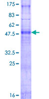 PIGC Protein - 12.5% SDS-PAGE of human PIGC stained with Coomassie Blue