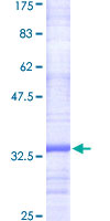 PIGC Protein - 12.5% SDS-PAGE Stained with Coomassie Blue.