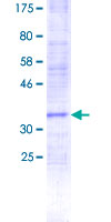 PIGF Protein - 12.5% SDS-PAGE Stained with Coomassie Blue.