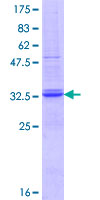 PIGG Protein - 12.5% SDS-PAGE Stained with Coomassie Blue.
