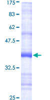 PIGH Protein - 12.5% SDS-PAGE Stained with Coomassie Blue.
