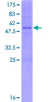 PIGL Protein - 12.5% SDS-PAGE of human PIGL stained with Coomassie Blue