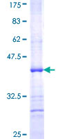 PIGL Protein - 12.5% SDS-PAGE Stained with Coomassie Blue.