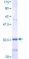 PIGM Protein - 12.5% SDS-PAGE Stained with Coomassie Blue