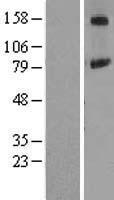 PIGN Protein - Western validation with an anti-DDK antibody * L: Control HEK293 lysate R: Over-expression lysate