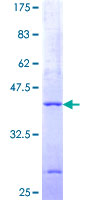PIGP Protein - 12.5% SDS-PAGE of human PIGP stained with Coomassie Blue