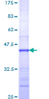 PIGR Protein - 12.5% SDS-PAGE Stained with Coomassie Blue.