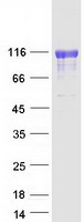 PIGR Protein - Purified recombinant protein PIGR was analyzed by SDS-PAGE gel and Coomassie Blue Staining