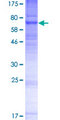 PIGV Protein - 12.5% SDS-PAGE of human PIGV stained with Coomassie Blue