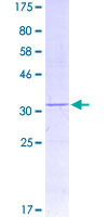 PIGY Protein - 12.5% SDS-PAGE of human PIGY stained with Coomassie Blue
