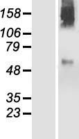 PIGZ Protein - Western validation with an anti-DDK antibody * L: Control HEK293 lysate R: Over-expression lysate